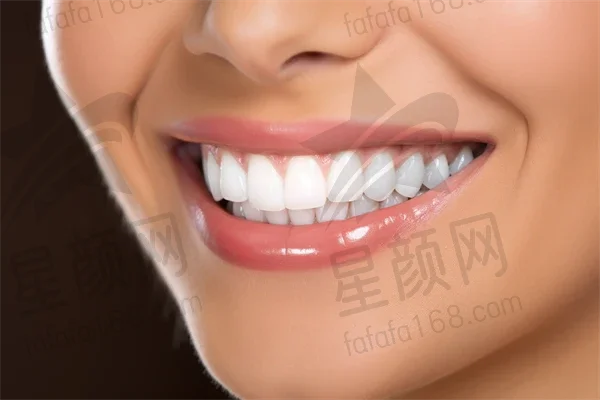 赣州牙齿美白费用是多少？2025年牙齿美白价格详解，重点关注牙齿美白多少钱，顺便提及洁牙费用。