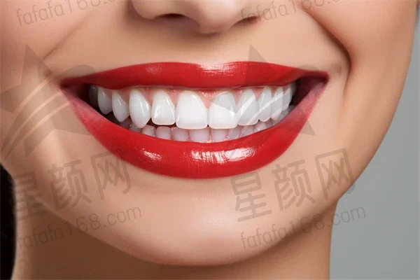 荆州牙齿矫正费用是多少？2025年新牙齿矫正价格表，特别关注牙齿矫正多少钱，顺便提及spark隐形矫正费用。