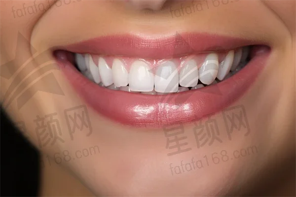 在驻马店啄木鸟口腔门诊部体验牙齿美白项目的真实感受与结果分享，揭示美白过程与结果的真实体验。