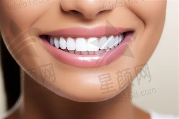 阜阳牙齿美白费用是多少？2025年牙齿美白价格表公布，四环素牙美白费用也一并提及。