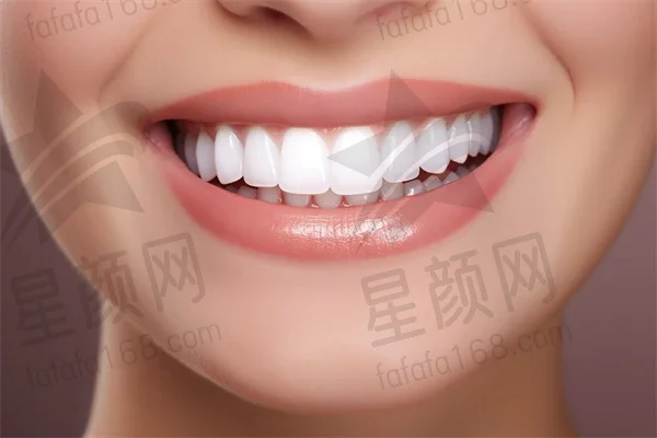 柳州活动义齿费用是多少？2025年活动义齿价格表揭晓，特别关注活动义齿的费用，同时简要提及胶托局部活动义齿的价格。