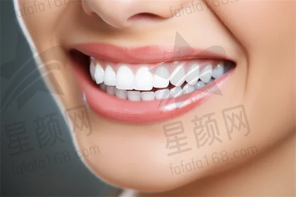 贵阳牙齿矫正费用是多少？2025年牙齿矫正价格一览，特别关注时代天使隐形矫正angelalign的费用。
