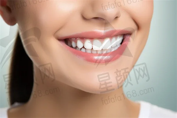淮安牙齿美白费用多少？2025年牙齿美白价格表揭晓，激光美白价格也将一并介绍！