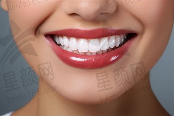 全瓷牙如何有效美白牙齿？探索美白全瓷牙的很不错方法与技巧