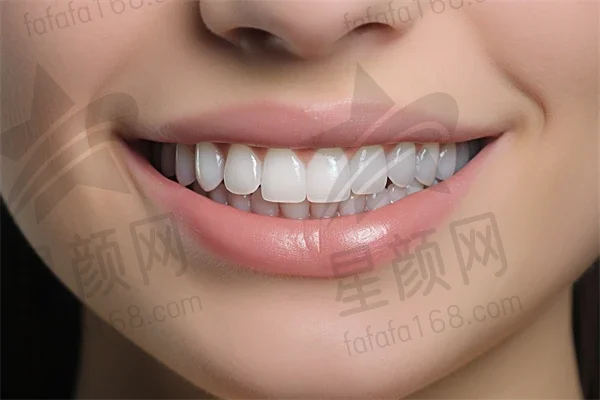 甘肃牙齿美白费用是多少？2025年牙齿美白价格表揭晓，冷光美白价格也一并介绍！