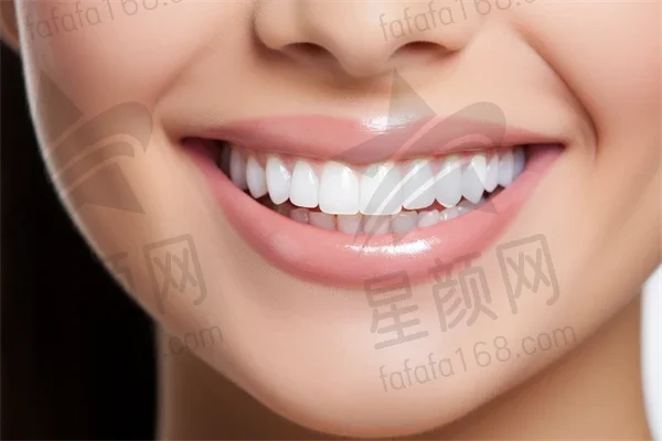 哈尔滨牙齿美白费用是多少？2025年牙齿美白价格详解，重点关注美白费用与冷光美白价格。