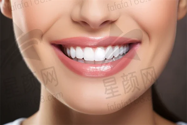 探索长治长兴口腔医院烤瓷牙项目：见证我牙齿华丽转变的精彩旅程与美丽蜕变的故事。