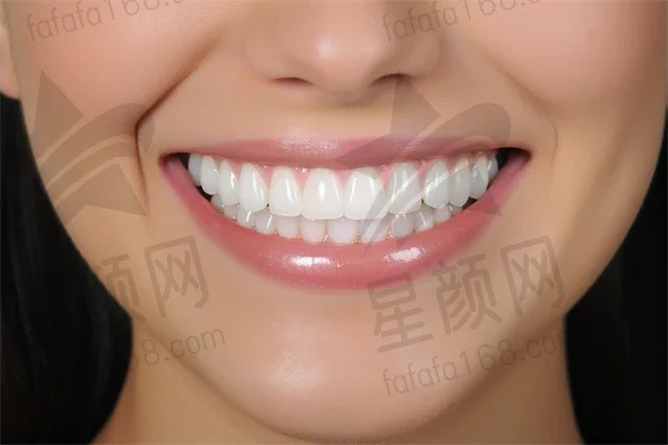 体验回顾：在呼和浩特欧贝口腔(中山一店)拔牙的全过程与个人感受分享，带你深入了解我的就医经历。