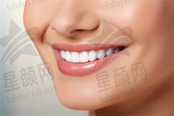 惠城牙齿美白费用是多少？2025年牙齿美白价格一览，特别关注四环素牙的美白费用。