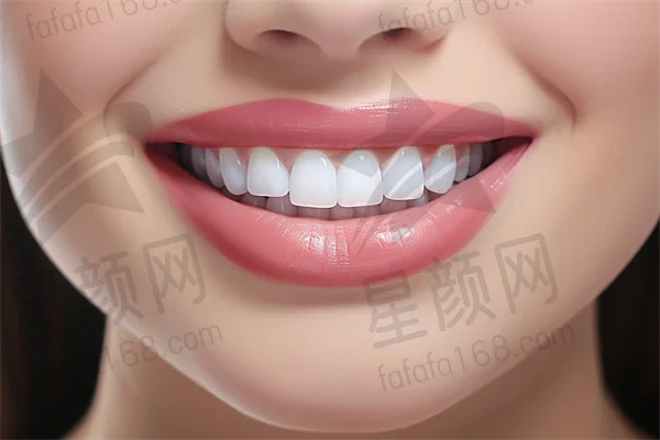 在达州亚康口腔医院进行牙齿矫正，收获自信的微笑与美丽的蜕变！