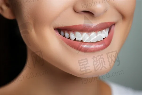 衡阳牙齿美白费用是多少？2025年牙齿美白价格详解，特别关注皓齿美白的价格信息。