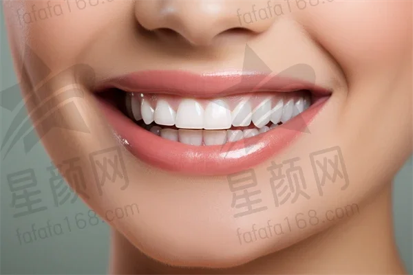 永州牙齿矫正费用多少？2025年牙齿矫正价格详解，凸嘴矫正费用也一并说明！