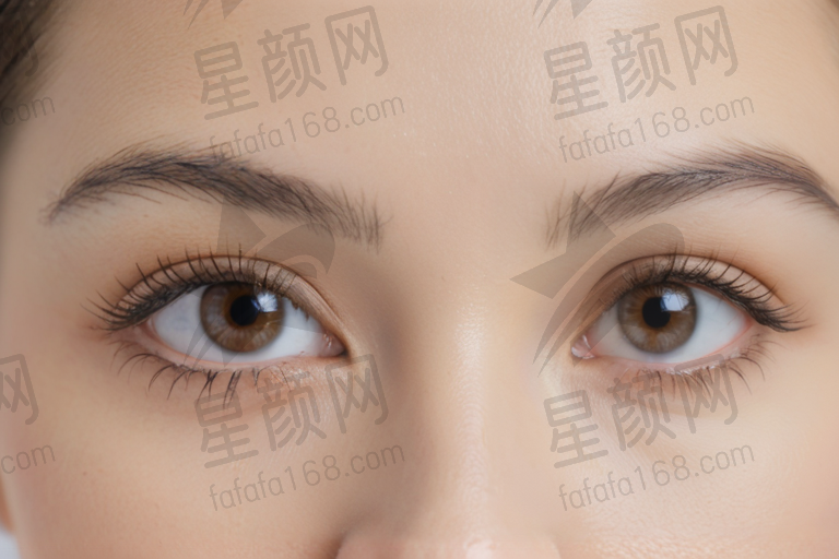 四川成都全激光近视眼手术的费用是多少？高度近视患者能否进行激光手术？