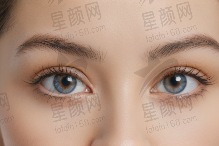 上海黑马眼科门诊部ICL晶体植入费用低至3.08万元，李健民医生近视矫正值得信赖。