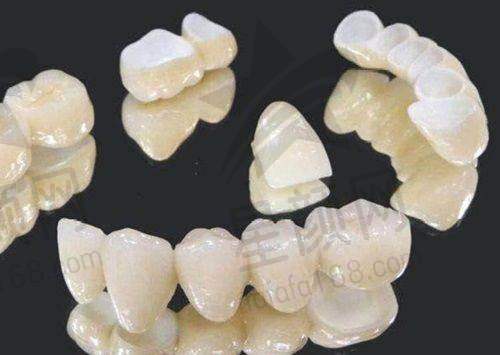 市场上的牙齿矫正价格参考