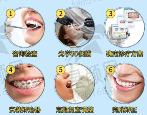 其他口腔项目及价格