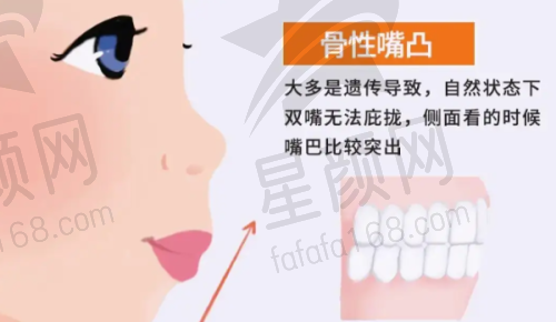丰富项目：满足多样需求