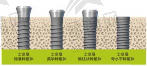 重庆璧山德奥口腔价格大揭秘！种植牙2280元起，矫正4980元起，地址在哪？