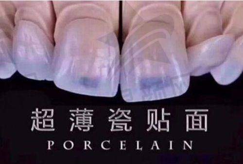 总结