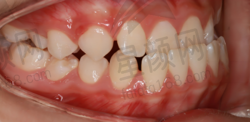 荣誉证书展示实力