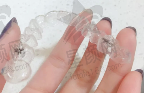 种牙项目亮点