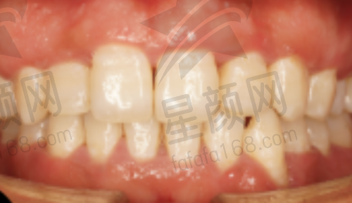 出租车路线