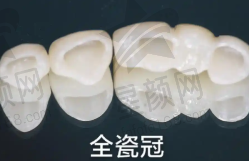 杭州上扬口腔医院的连锁情况
