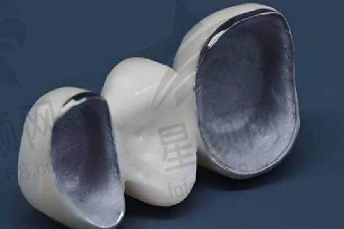 优势亮点