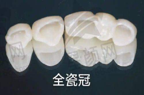 北京崇文口腔医院2025年价格表