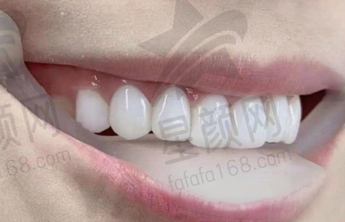 廊坊焦点口腔门诊部靠谱性