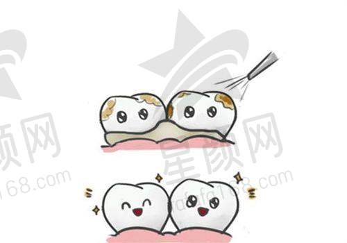 河源整牙好去处