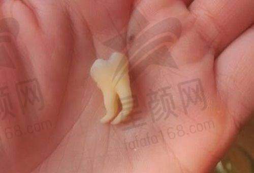 株洲十大种植牙医院排名榜中的实力担当
