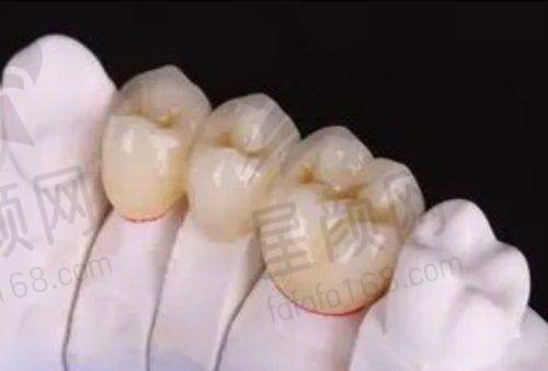 总结