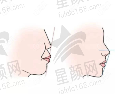 总结