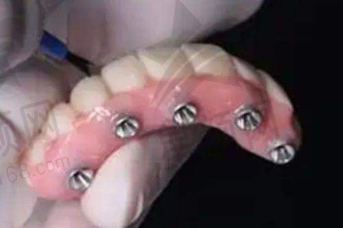 总结