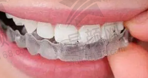 总结