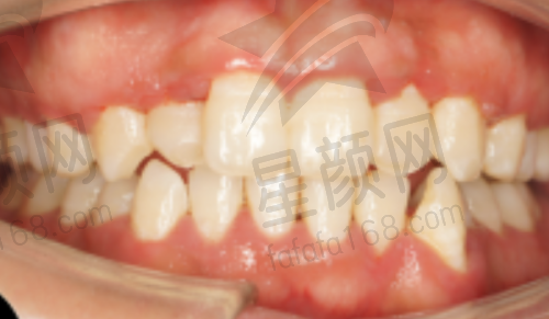 潍坊奎文区口腔医院与其他医院的对比